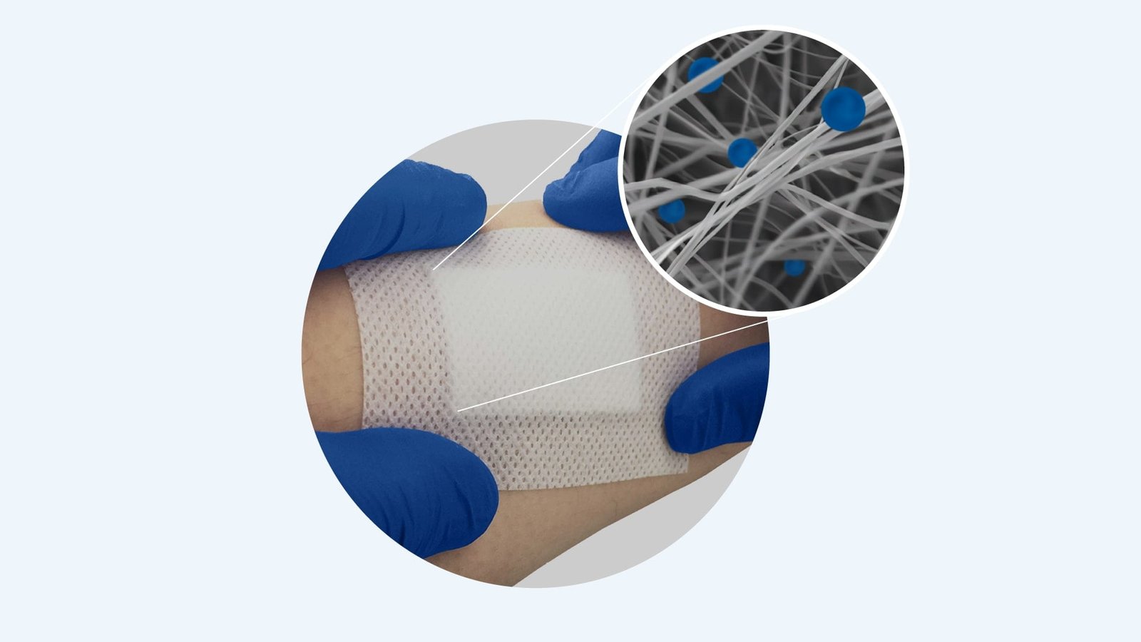 Nanordica Medical haavaside - Kerti Kulper