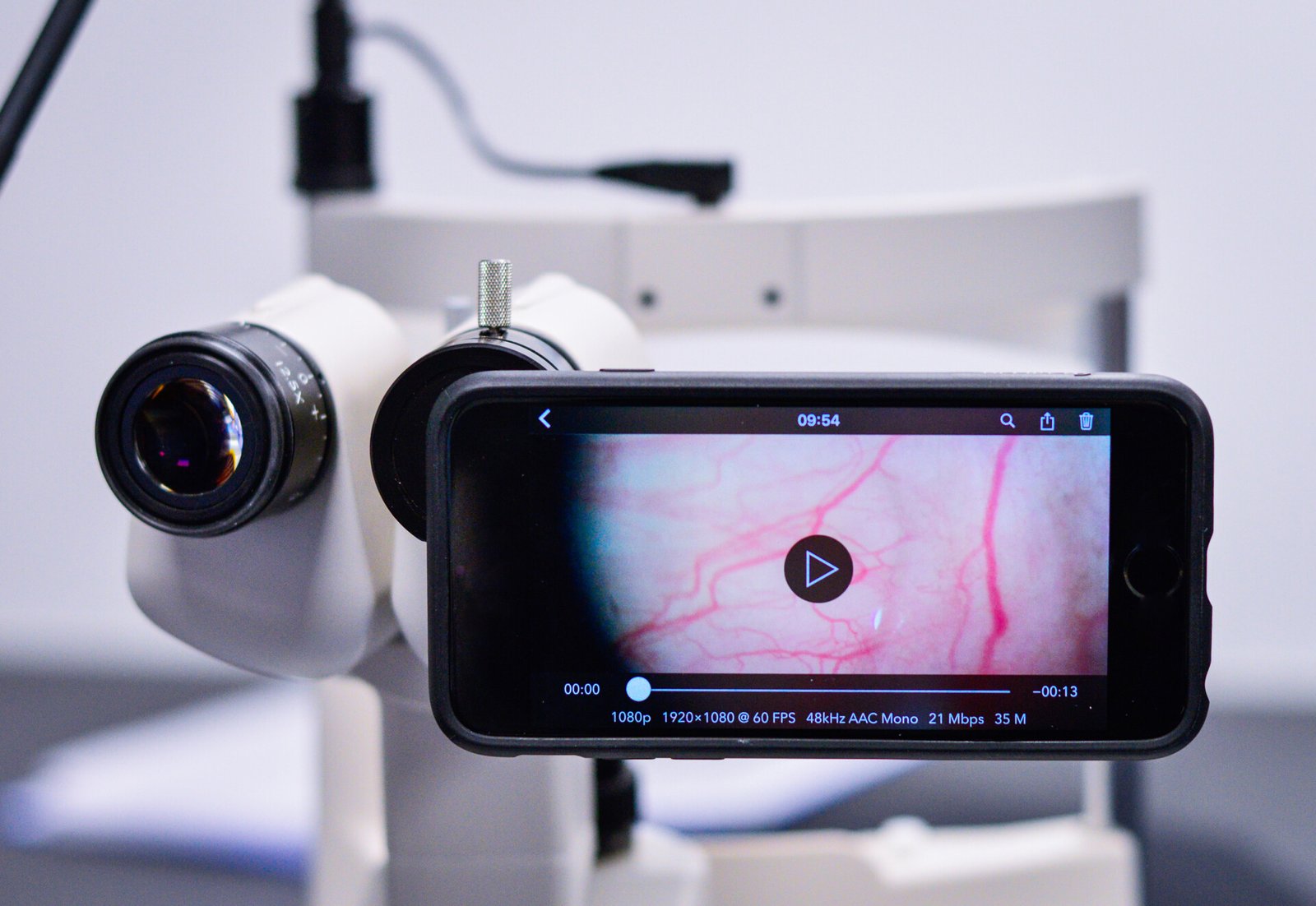 Smartphone attached to slit lamp for human eye examination.